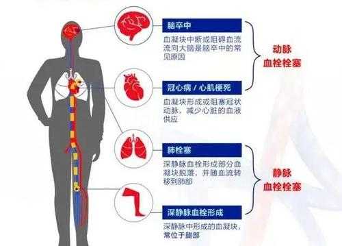 血栓语言功能受损（血栓导致语言障碍多久能恢复正常）